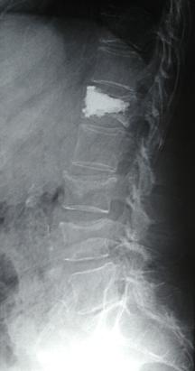 sag rx post